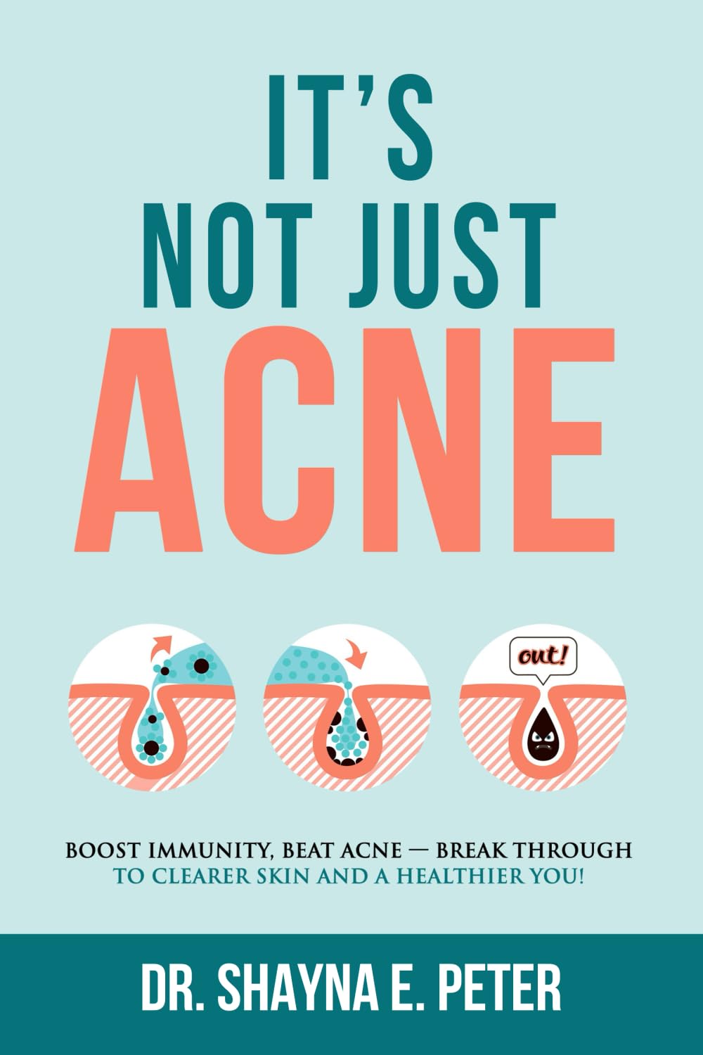 It's Not Just Acne: Boost Immunity, Beat Acne - Break Through to Clearer Skin & A Healthier You!